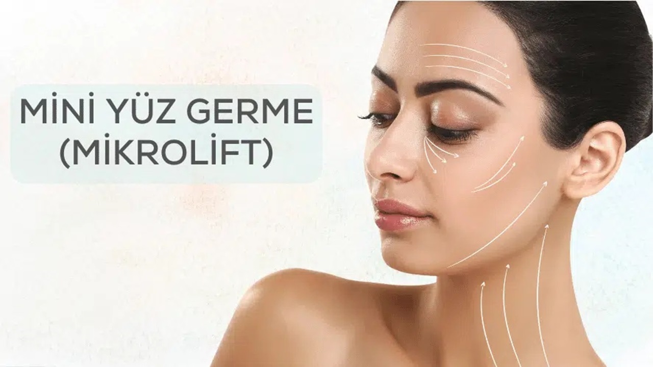 Cildinize Minik Dokunuşlar için Mini Yüz Gerdirme Ameliyatı