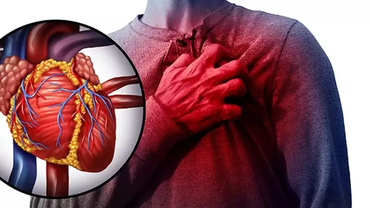 Aort Yırtılması Nedir? Belirtileri Nelerdir?